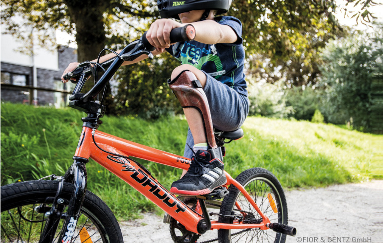 Huesing-Rehatechnik-Orthopaedietechnik-Sitzschale-FiNiFuchs-Kinderrollstuhl