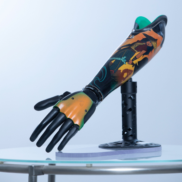 Myoelektrische Prothese