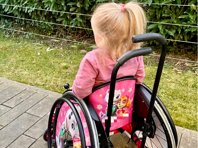 Spina Bifida Spina Bifida