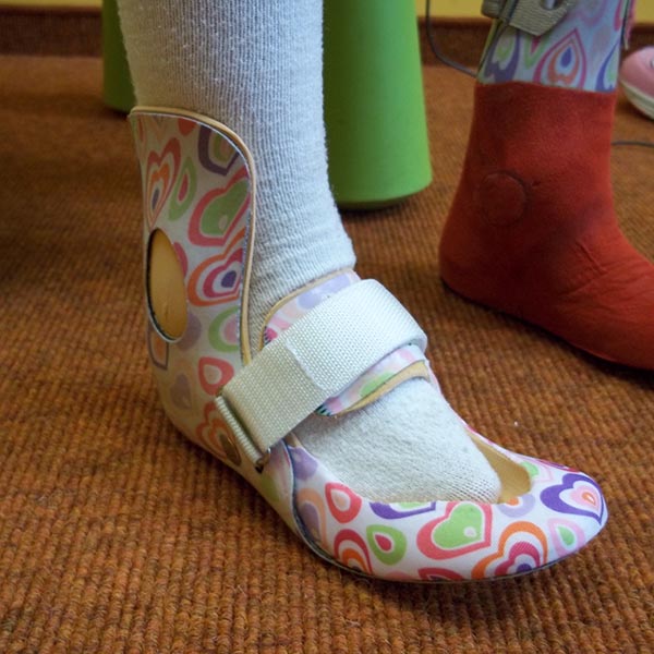 Versorgungen nach sensomotorischen Wirkprinzipien